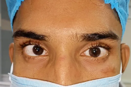 Squint-Evaluation-Treatment